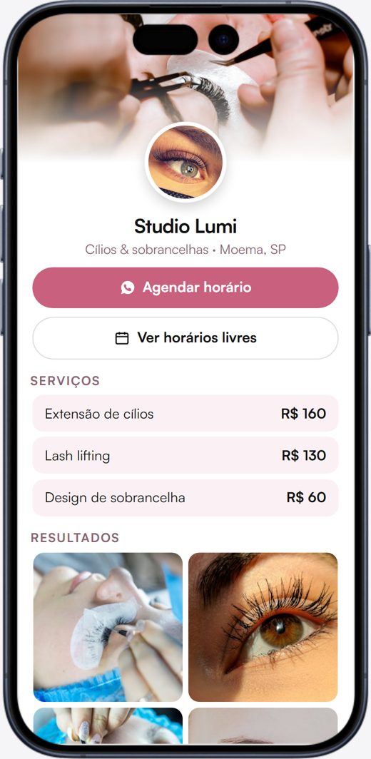 Modelo Estética